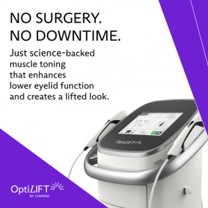 OptiLift treatment at Vision Trends